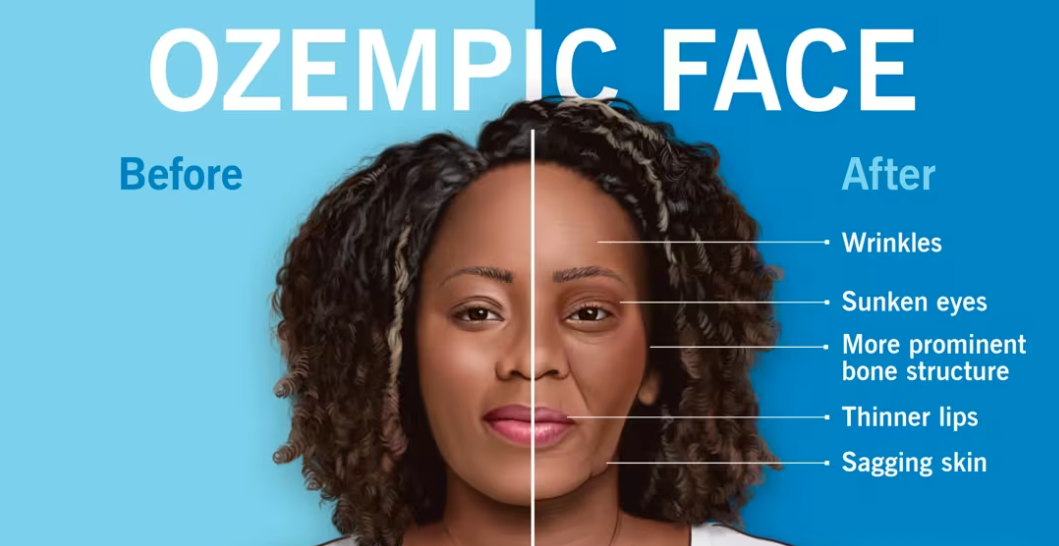 TikTok爆款减肥贴片25天卖270万美元！Kind Patches凭GLP-1概念与2.6万达人营销登顶